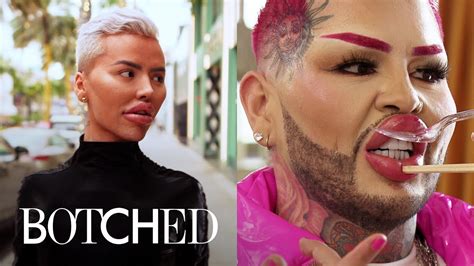 Botched Has More Work to Be UNDONE - New Season Aug. 3 | Botched | E ...