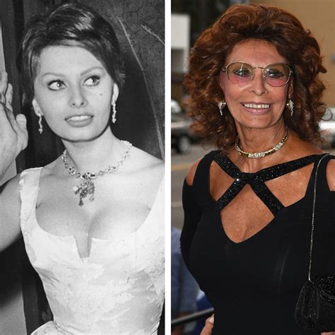 Sophia Loren Plastic Surgery Before And After