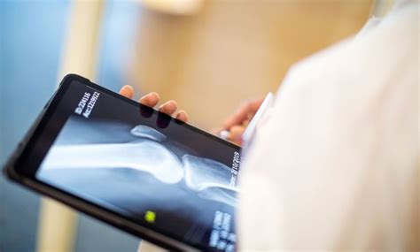 Bone loss: symptoms, causes and treatment - US Today News