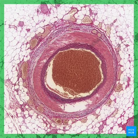 Pulmonary Artery Histology