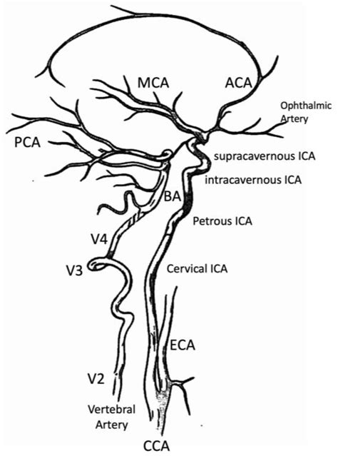 Anatomia | Free Full-Text | Anatomy of Cerebral Arteries with Clinical Aspects in Patients with ...