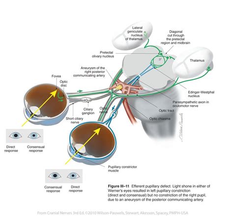 Oculomotor III - Cranial Nerves | Cranial nerves, Nerve, Anatomy and ...