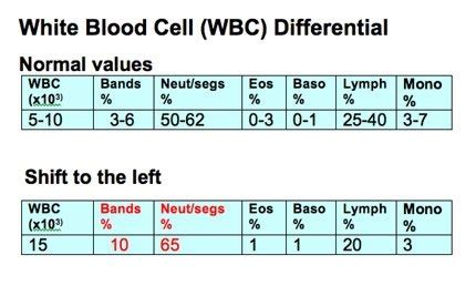 What Is a Shift to the Left in Blood Testing? | eHow