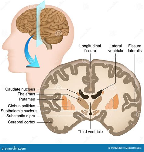 Coronal Section of the Human Brain Medical Illustration Stock Vector - Illustration of disease ...