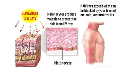 Ultraviolet Rays Effects On Humans