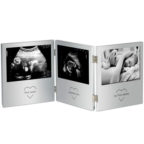 VonHaus Baby Scan Photo Frame - Picture Frame for Sonogram, Gender ...