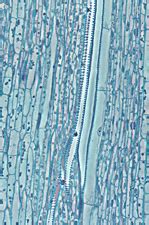 Xylem Development