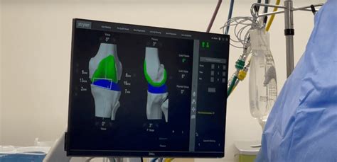 Mako: Robotic-Assisted Knee Replacement - Denver Area