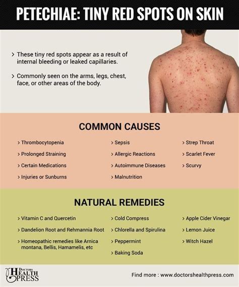 What Are These Tiny Red Spots On My Skin? Causes & Remedies | Serious skin care, Skin spots ...