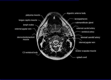 Ct Neck Axial Anatomy Anatomy Radiology Imaging Anatomy Of The Neck ...