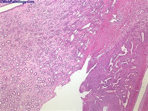 Webpathology.com: A Collection of Surgical Pathology Images