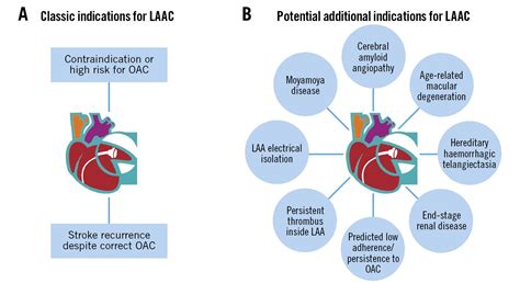 Percutaneous left atrial appendage closure: beyond the classic indications – AsiaIntervention