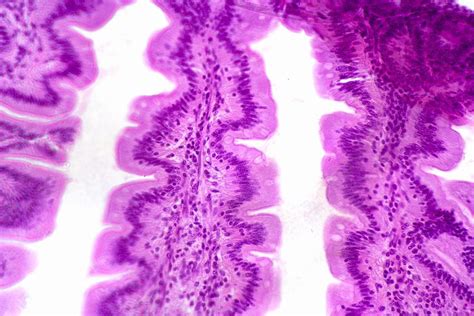 What Is the Jejunum and What Is Its Function?