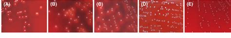 Streptococcus Dysgalactiae