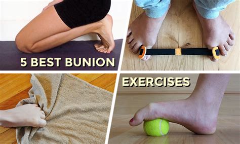 5 Best Bunion Exercises | Before or After Surgery — Feet&Feet