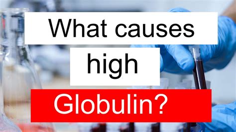 What causes high Globulin and low Eosinophils?