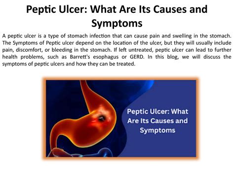 What Signs and Symptoms Indicate a Peptic Ulcer? by Safe Surgery Center ...