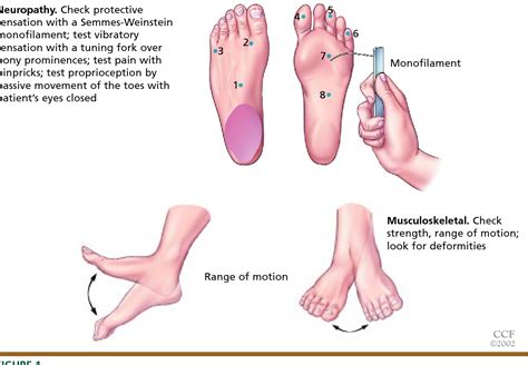 How To Do A Diabetic Foot Check - DiabetesWalls