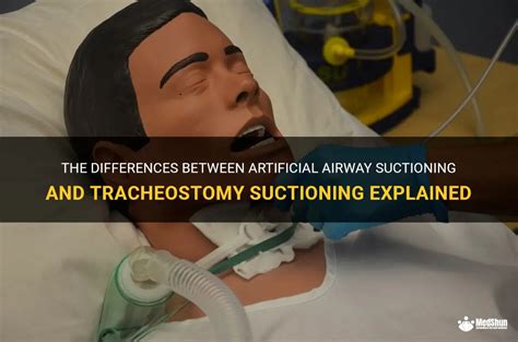 The Differences Between Artificial Airway Suctioning And Tracheostomy ...