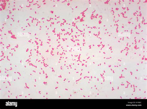 This Gram-stained photomicrograph depicts numerous Gram-negative Stock Photo: 155843924 - Alamy