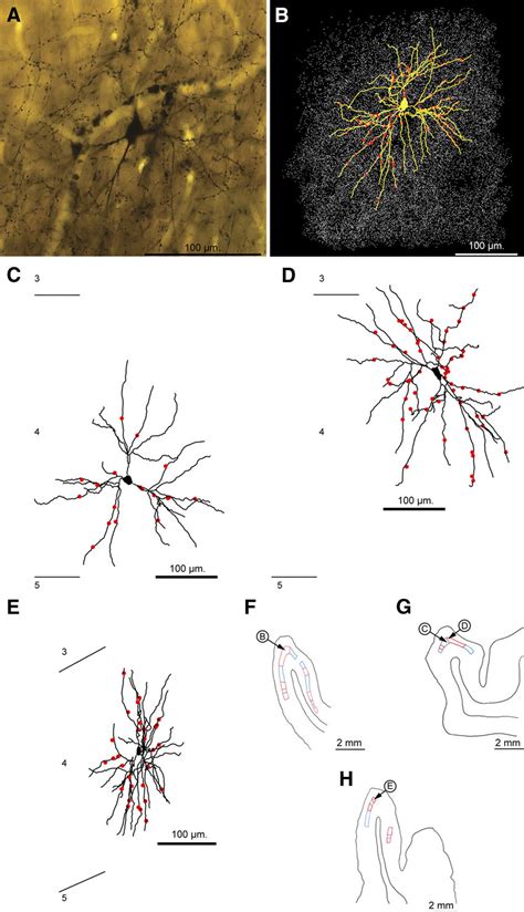 Spiny stellate cells. A, Light micrograph of spiny stellate cell ...