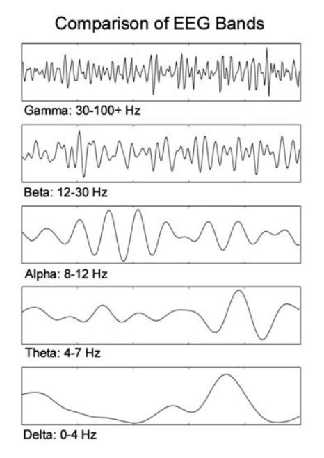 neuroscience - What is the significance of the amplitude of brain waves? - Biology Stack Exchange