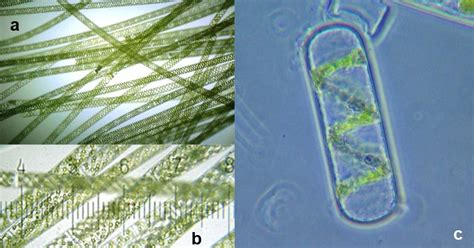 Genus Spirogyra – An Overview | Alternation of generations, Vegetative reproduction, Aquatic ...