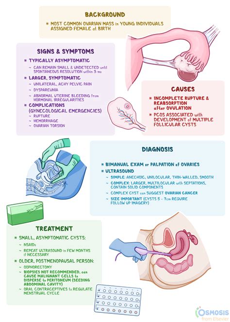 Ovarian Cyst Simple Vs. Complex Hotsell | cdlguaiba.com.br