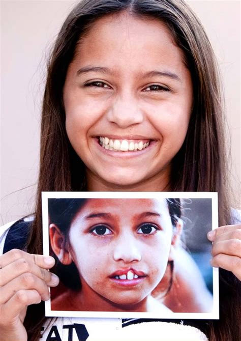 Operation Smile Reveals 10-Year-Commitment For More Smiles