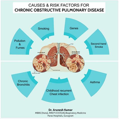 Dr. Arunesh Kumar Pulmonologist: Causes & Risk Factors of Chronic obstructive pulmonary disease ...