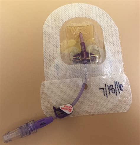 Understanding Your Peripherally Inserted Central Catheter (PICC ...