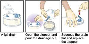 Hemovac Drain Picture - Best Drain Photos Primagem.Org