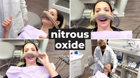 Laughing Gas at the Dentist | What to Expect from Dental Nitrous Oxide - YouTube