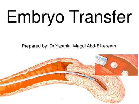 Embryo transfer