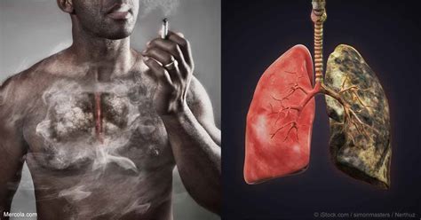 What Happens to Your Body When You Smoke