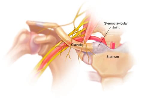 Sternoclavicular Joint Injuries: When to Consider Surgery, And How Is ...