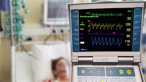 Icu Patient With Ecg Monitor Iabc Stock Footage SBV-301158524 - Storyblocks