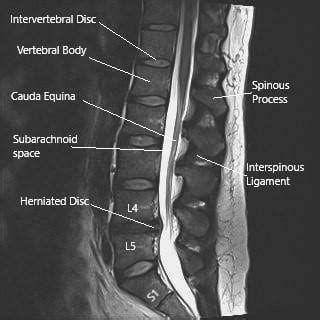 Sciatic Nerve - Anatomy - Complete Orthopedics & Podiatry | Multiple NY Locations