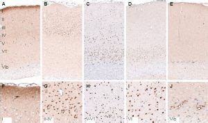 Cortical Layer Markers from Atlas Antibodies