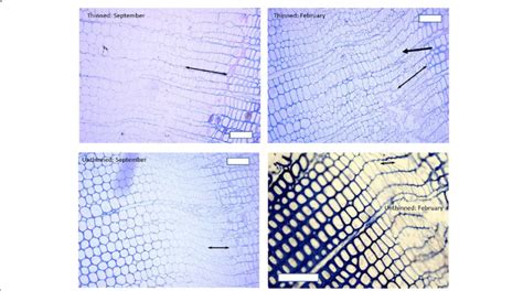 Examples of the cambium and zone of enlarging xylem from thinned and... | Download Scientific ...