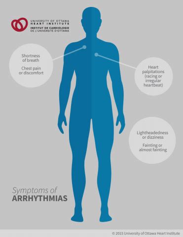 Arrhythmias (Heart Rhythm Disorders) - Ottawa Heart Institute