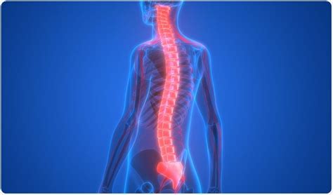 Spinal Muscular Atrophy Types - Thailand Medical News