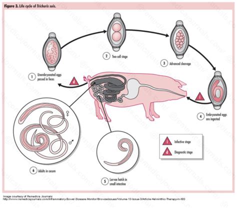 Trichuris Life Cycle