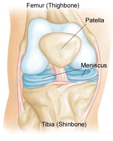 3D printed hydrogel knee implants mimics meniscus knee cartilage - 3D Printing Industry