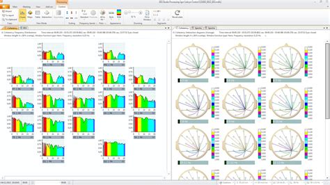 EEG Studio Clinical software – Mitsar :: Neurodiagnostics ...