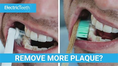 Electric Toothbrush To Remove Plaque