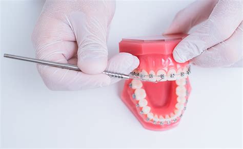 Dentures and Denture Implant Near Me | Go Dental Studio