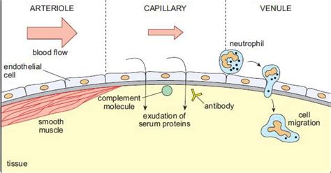 Acute Inflammation - TeachMeSurgery