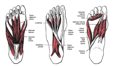 Plantar Heel Pain - Physiopedia