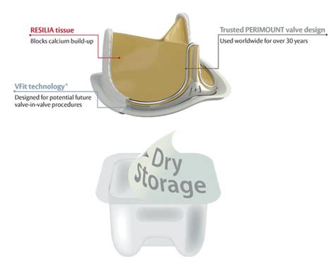 Breakthrough: INSPIRIS RESILIA Aortic Valve Gets FDA Approval | Heart surgery, Breakthrough, Valve